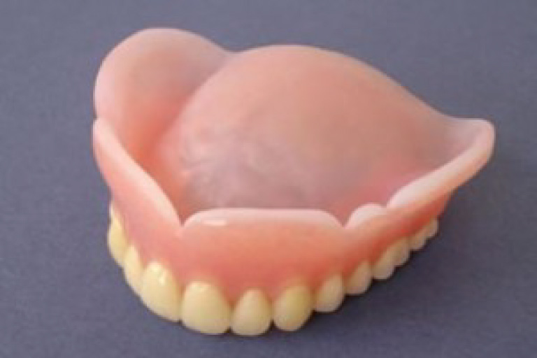 口腔粘膜にやさしいシリコン義歯