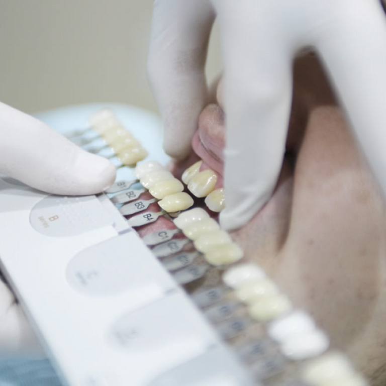 歯科技工士が現場に赴き、患者さまのお口の中を直接確認します。