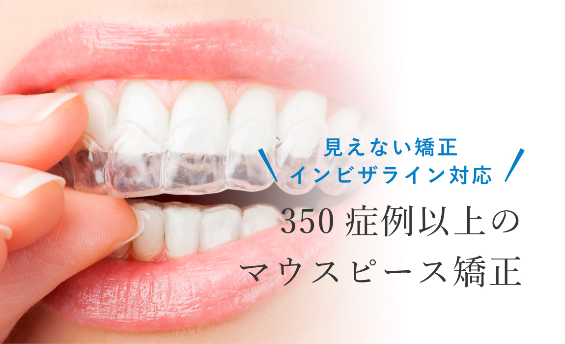 マウス ピース 矯正 失敗