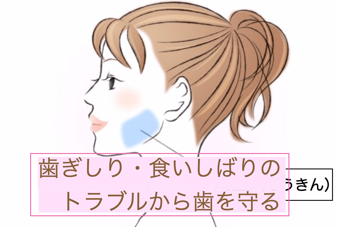 歯科ボトックス（エラボトックス）とはの外観